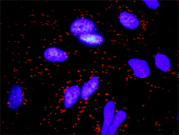 FGF10 monoclonal antibody (M05), clone 3C7