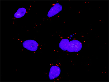 FGF5 purified MaxPab rabbit polyclonal antibody (D01P)
