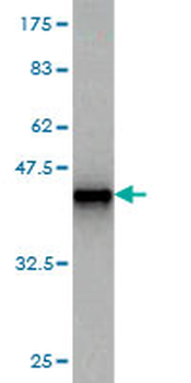 FGF1 monoclonal antibody (M01), clone 3F5