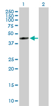 FDFT1 purified MaxPab mouse polyclonal antibody (B01P)