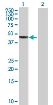 FDFT1 MaxPab mouse polyclonal antibody (B01)
