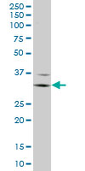 FCGR3A monoclonal antibody (M03A), clone 2B11