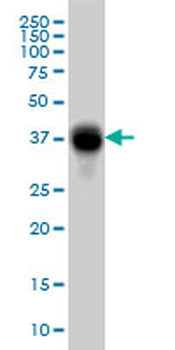 FCGR2B monoclonal antibody (M01A), clone 2E10