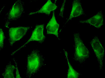 FAU monoclonal antibody (M03), clone 3C10
