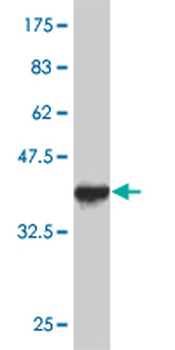 FAP monoclonal antibody (M01), clone 1E5