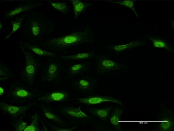 FANCF purified MaxPab mouse polyclonal antibody (B01P)