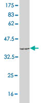 ACSL1 monoclonal antibody (M02), clone 3G4