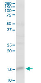 FABP5 purified MaxPab rabbit polyclonal antibody (D01P)