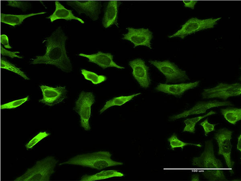 FABP4 monoclonal antibody (M05), clone 3G1