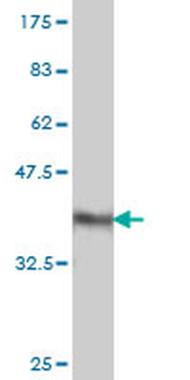 F11 monoclonal antibody (M01), clone 2H8