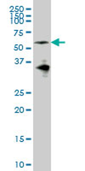 EYA2 monoclonal antibody (M04), clone 2F8