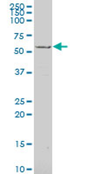 EYA1 polyclonal antibody (A01)