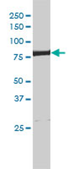 ERCC2 monoclonal antibody (M01), clone 4G2-2A6