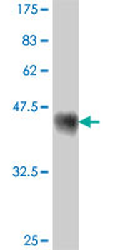 EPB41 polyclonal antibody (A01)