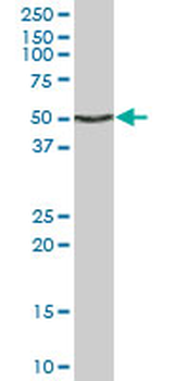 ENO1 monoclonal antibody (M10), clone 9E4