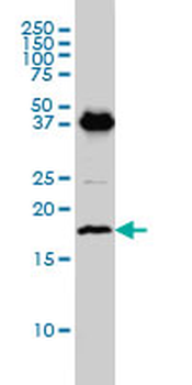 EMP3 monoclonal antibody (M01), clone 3D4