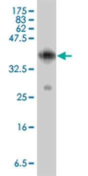 EMP1 polyclonal antibody (A01)