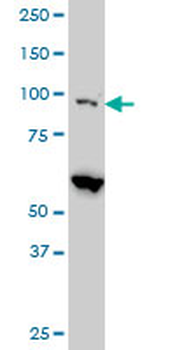 EIF4G2 monoclonal antibody (M01), clone 3B5