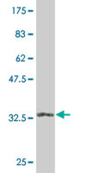 EIF4EBP2 monoclonal antibody (M04), clone 2G8