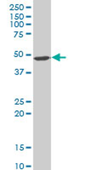 EIF4A2 polyclonal antibody (A01)