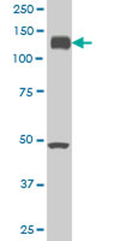 EPHA2 monoclonal antibody (M02), clone 1E3