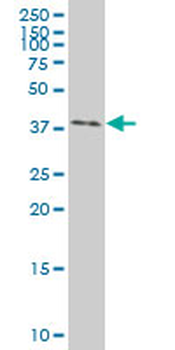 EFNB2 polyclonal antibody (A01)