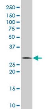 EFNA5 polyclonal antibody (A01)