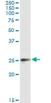 EFNA3 monoclonal antibody (M10), clone 2H3