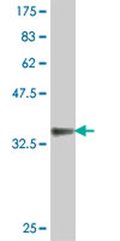 EFNA3 polyclonal antibody (A01)