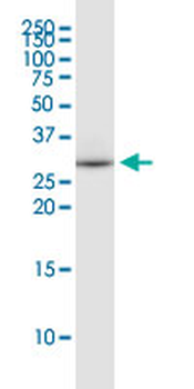 EEF1B2 monoclonal antibody (M18), clone 2G10