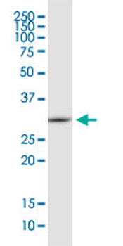 EEF1B2 monoclonal antibody (M14), clone 2G6