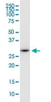 EEF1B2 monoclonal antibody (M12), clone 3F9