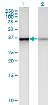 PHC2 monoclonal antibody (M01), clone 1F4