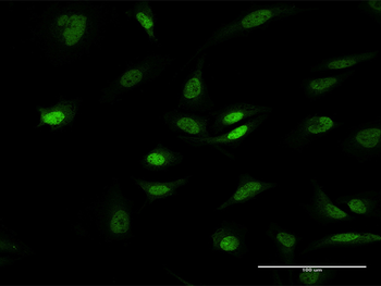 PHC1 purified MaxPab mouse polyclonal antibody (B01P)