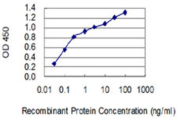 EDNRB monoclonal antibody (M01), clone 5H2