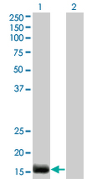 EDN2 monoclonal antibody (M01), clone 3B4-1C5