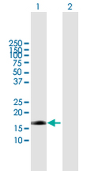 EDN2 purified MaxPab mouse polyclonal antibody (B01P)