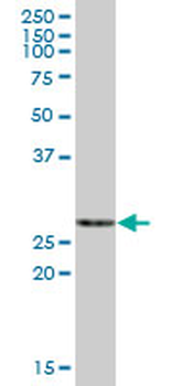 ECHS1 purified MaxPab mouse polyclonal antibody (B01P)