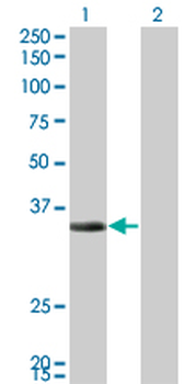 ECH1 monoclonal antibody (M01), clone 5G8