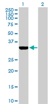 ECH1 purified MaxPab rabbit polyclonal antibody (D01P)