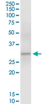 ECH1 MaxPab rabbit polyclonal antibody (D01)