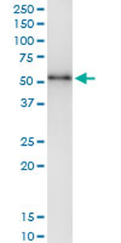 TYMP MaxPab rabbit polyclonal antibody (D01)
