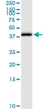 E2F6 MaxPab rabbit polyclonal antibody (D01)