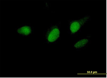 E2F6 MaxPab mouse polyclonal antibody (B01P)