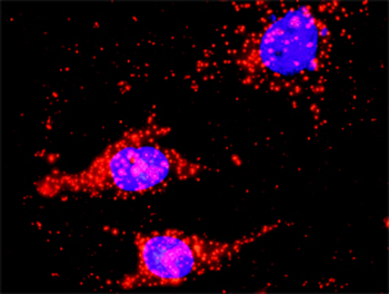 DVL1 purified MaxPab rabbit polyclonal antibody (D01P)
