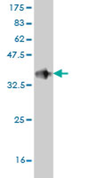 DUSP5 monoclonal antibody (M04), clone 2F3