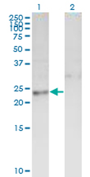 DTYMK monoclonal antibody (M01A), clone 2C2