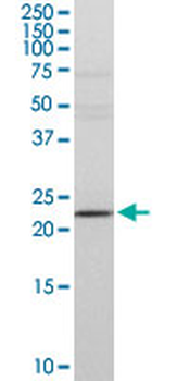 DTYMK purified MaxPab rabbit polyclonal antibody (D01P)