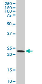 DTYMK polyclonal antibody (A01)