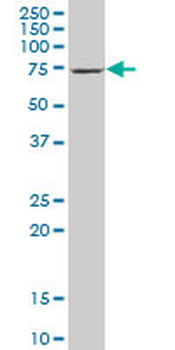 DTNB polyclonal antibody (A01)